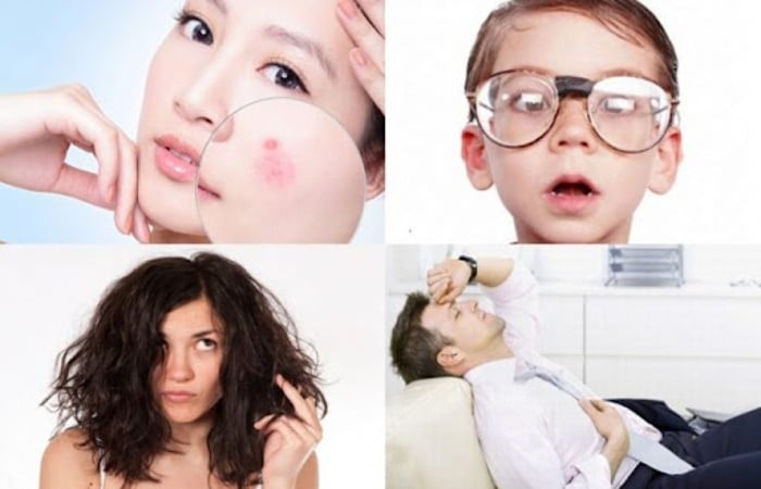 Dấu hiệu nhận biết thiếu khoáng