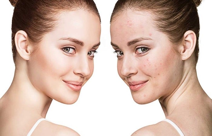 Phụ nữ mang thai hoặc cho con bú, những người đang sử dụng các loại thuốc khác nên tham khảo ý kiến của bác sĩ chuyên khoa trước khi sử dụng