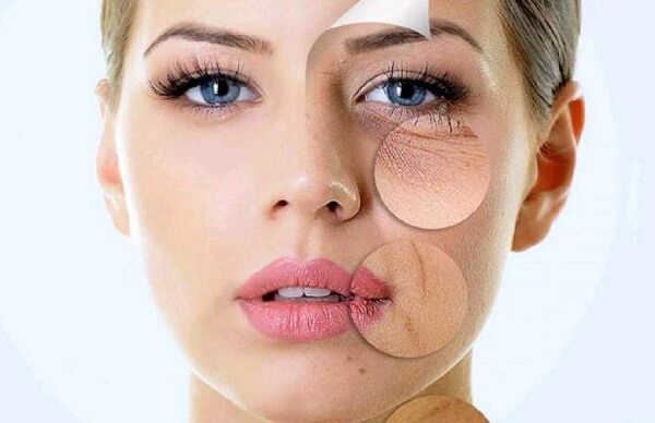 Vitamin C chống lão hóa gây ra bởi tia cực tím