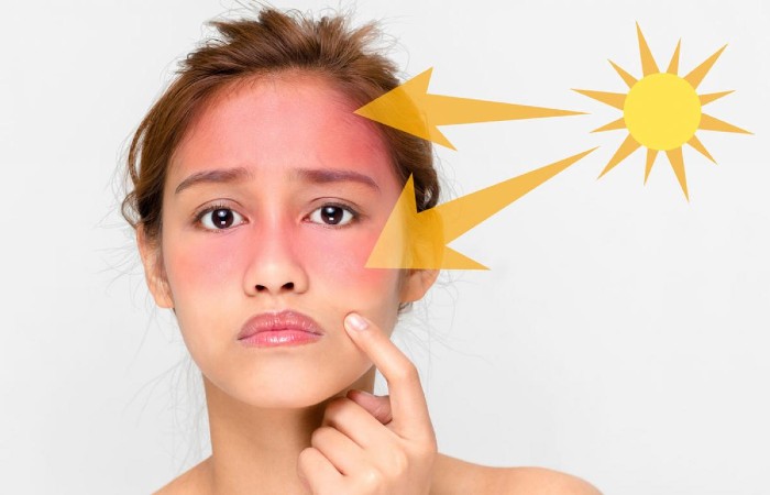 Vitamin C giúp bảo vệ da khỏi tác động từ ánh nắng mặt trời