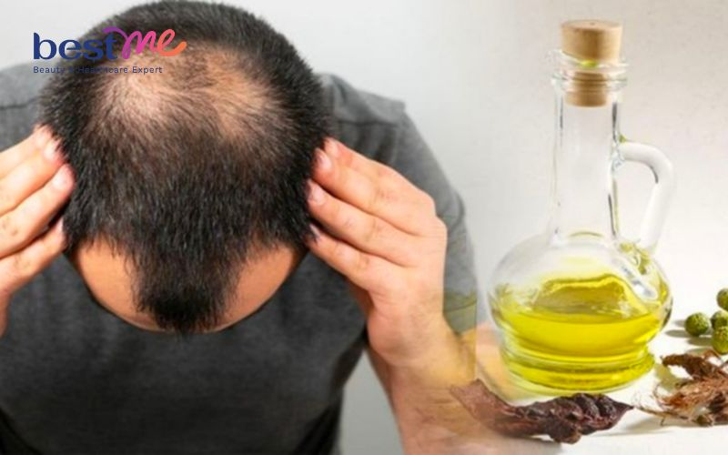 10-cach-duong-toc-nhanh-dai-cho-nam-trong-1-tuan-de-thuc-hien-5 10+ cách dưỡng tóc nhanh dài cho nam trong 1 tuần dễ thực hiện - 5