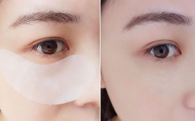10-loai-mat-na-mat-han-quoc-tot-nhat-giam-quang-tham-hieu-qua-11 10 loại mặt nạ mắt Hàn Quốc tốt nhất giảm quầng thâm hiệu quả - 11