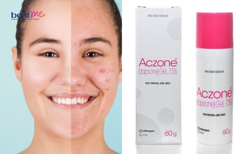 19 loại kem thuốc trị mụn nhọt hiệu quả tốt nhất [Có giá] - 10