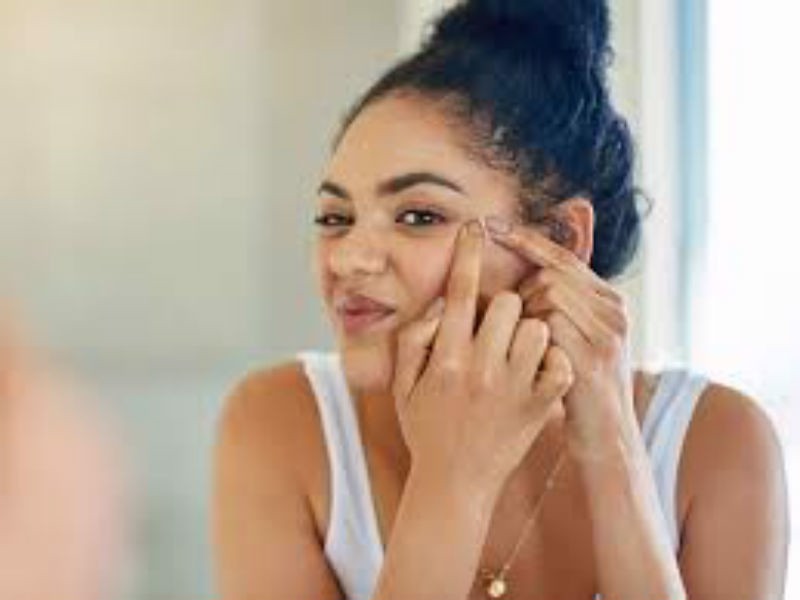 Có nên dùng kem dưỡng trị mụn không?