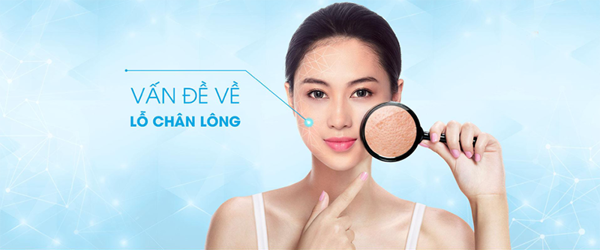 5 công dụng thần kỳ của nước hoa hồng trị mụn bạn nên biết - 3