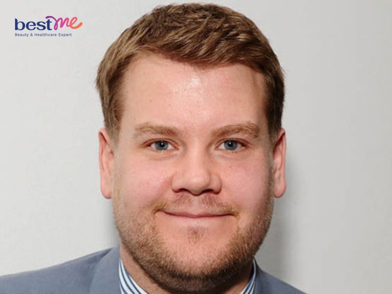 Những nguyên nhân gây mỡ mặt cho nam