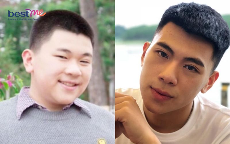 Vẻ ngoài thay đổi khi giảm mỡ mặt nam thành công