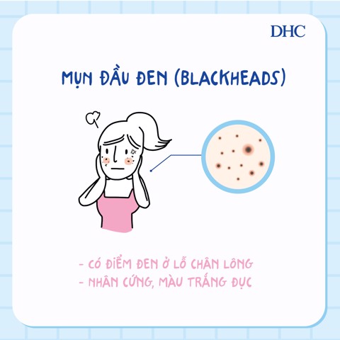 các loại mụn thường gặp