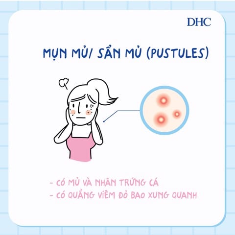 cách trị mụn mủ