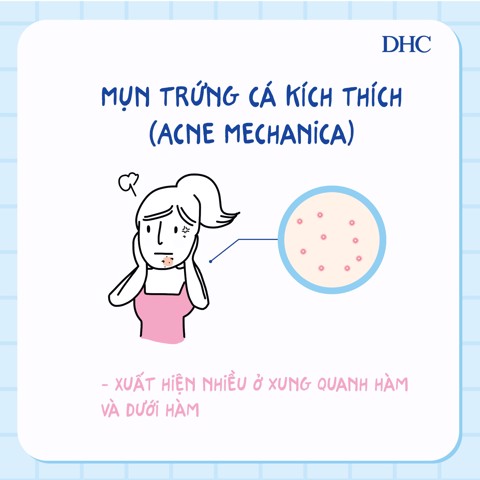 Mụn trứng cá kích thích