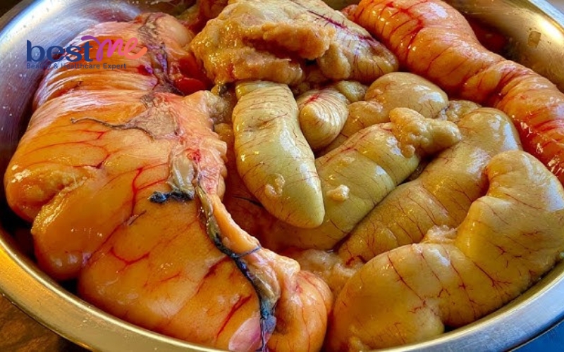 an-trung-ca-co-noi-mun-khong-huong-dan-cach-an-tot-nhat-4 Ăn trứng cá có nổi mụn không? Hướng dẫn cách ăn tốt nhất - 4