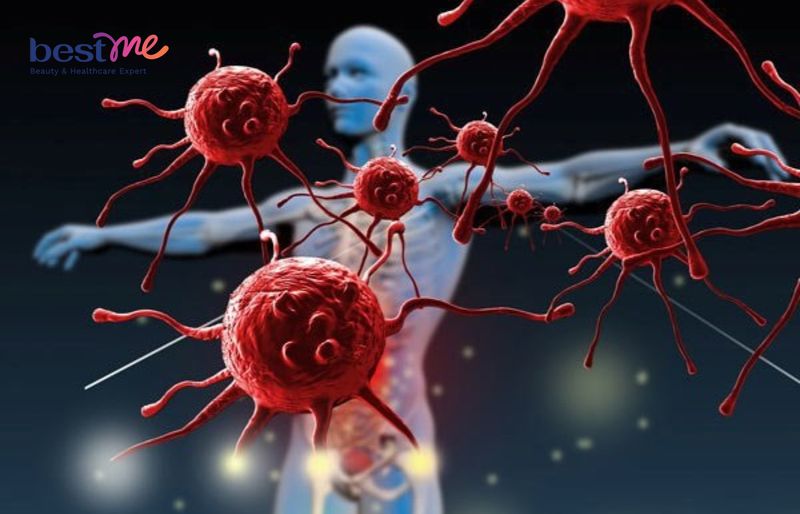 Anthocyanin giúp ngăn ngừa nhiều bệnh ung thư