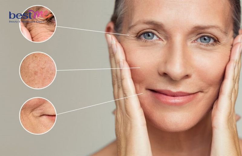 B5 giúp cải thiện tình trạng da chảy xệ, nhiều nếp nhăn