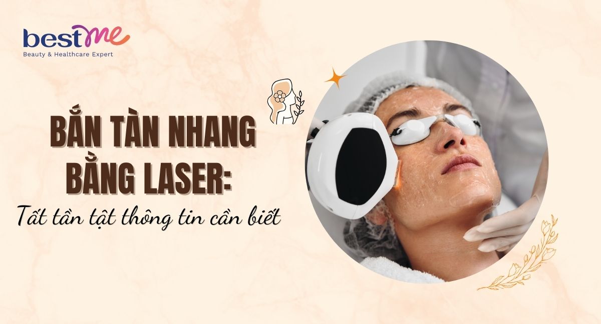 Bắn tàn nhang bằng Laser: Tất tần tật thông tin cần biết