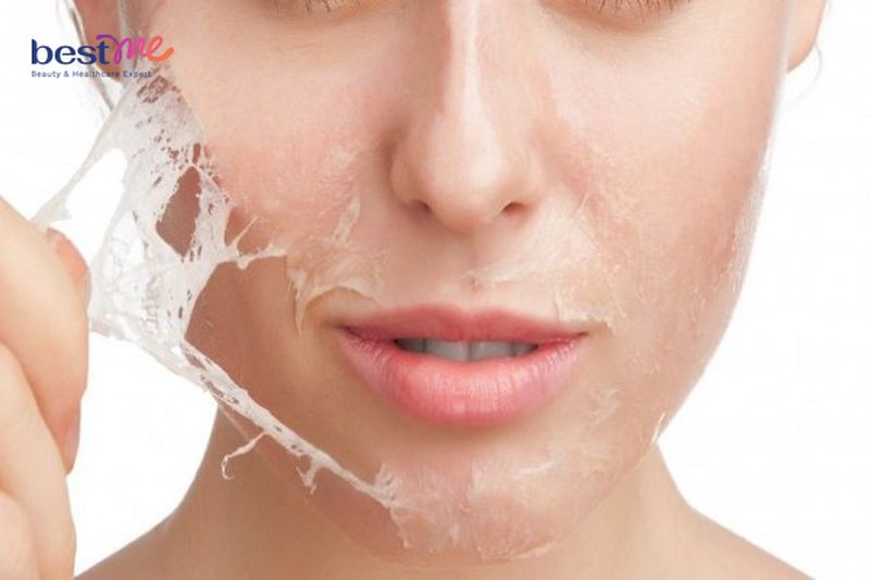 Peel mang lại nhiều tác dụng tích cực cho làn da