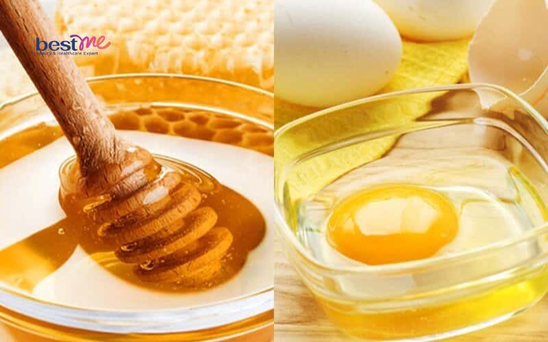 bat-mi-cach-tri-mun-boc-o-lung-hieu-qua-nhat-ngay-tai-nha-5 Bật mí cách trị mụn bọc ở lưng hiệu quả nhất ngay tại nhà - 5