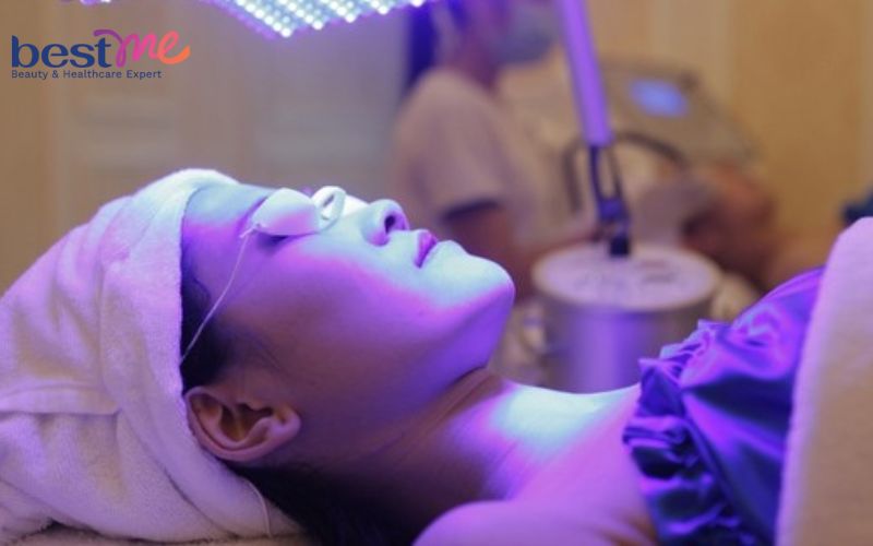 bat-mi-cach-tri-mun-cam-o-tran-hieu-qua-nhat-khong-tai-phat-6 Bật mí cách trị mụn cám ở trán hiệu quả nhất không tái phát - 6