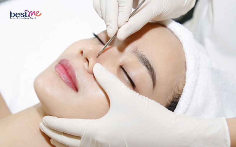 Bật mí cách trị mụn đá ở mắt, trên mặt hiệu quả nhanh nhất - 7