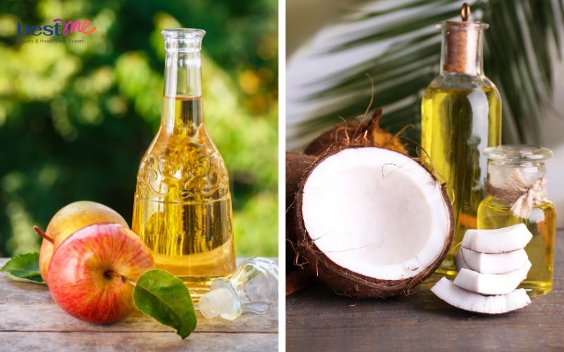 be-bi-noi-mun-dau-trang-la-benh-gi-cach-xu-ly-hieu-qua-6 Bé bị nổi mụn đầu trắng là bệnh gì? Cách xử lý hiệu quả - 6