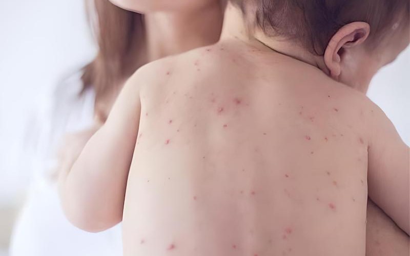 BESTME giải đáp: Mua vitamin A cho trẻ ở đâu? Giá bao nhiêu? - 1