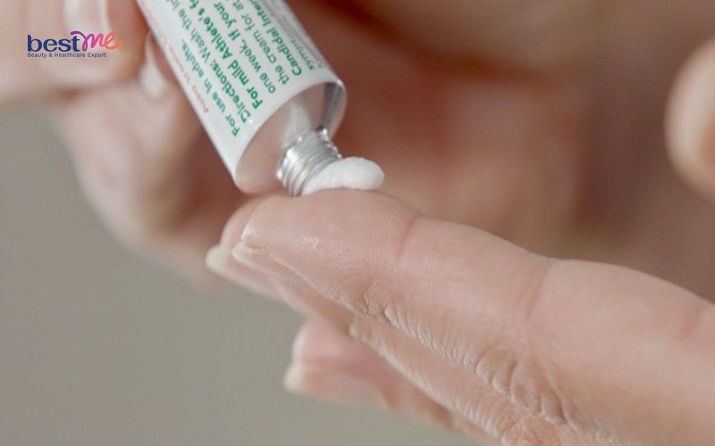 Một số loại thuốc hỗ trợ điều trị chàm da nhanh chóng