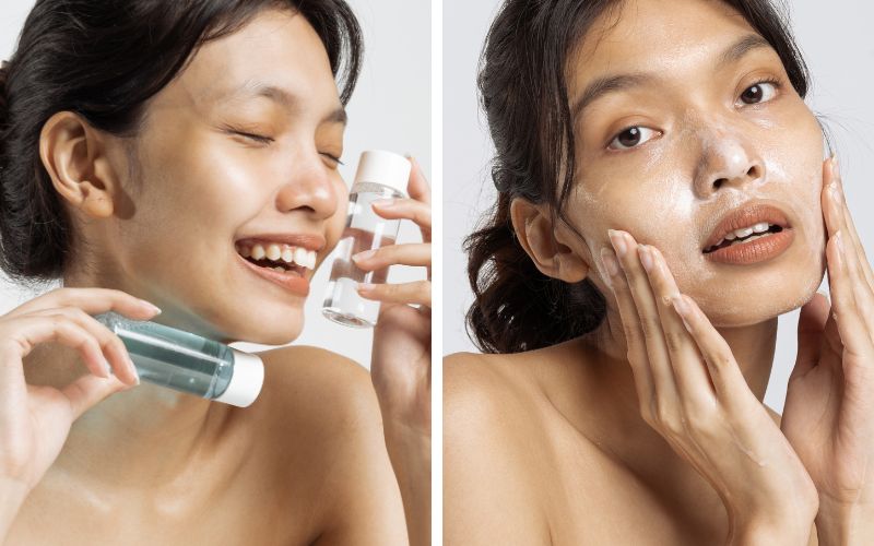 bi-day-mun-co-nen-nan-khong-nen-lam-gi-tot-va-an-toan-nhat-4 Bị đẩy mụn có nên nặn không? Nên làm gì tốt và an toàn nhất? - 4