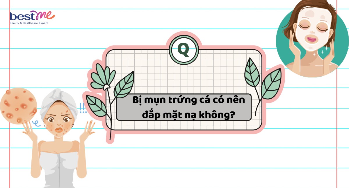 Giải đáp: Bị mụn trứng cá có nên đắp mặt nạ dưỡng da không?