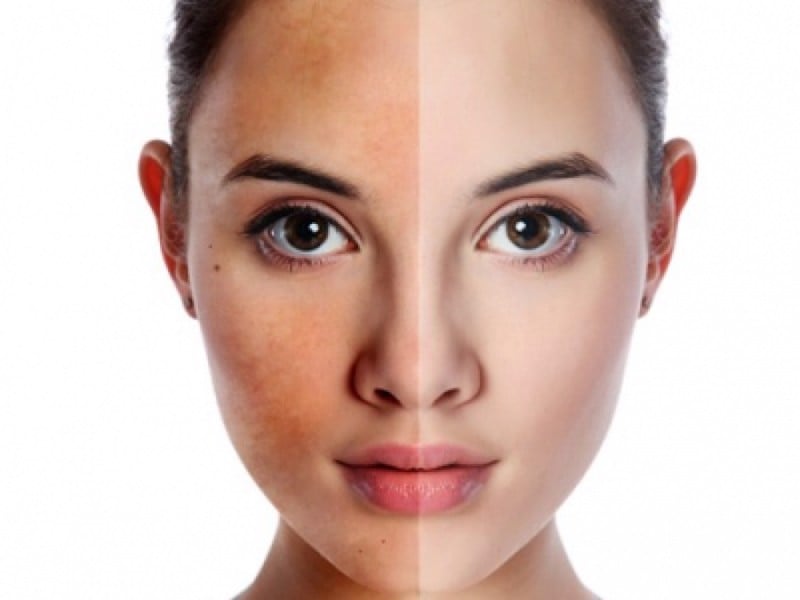 Tiết lộ cách chăm sóc da đẹp vào mùa hè không phải ai cũng biết