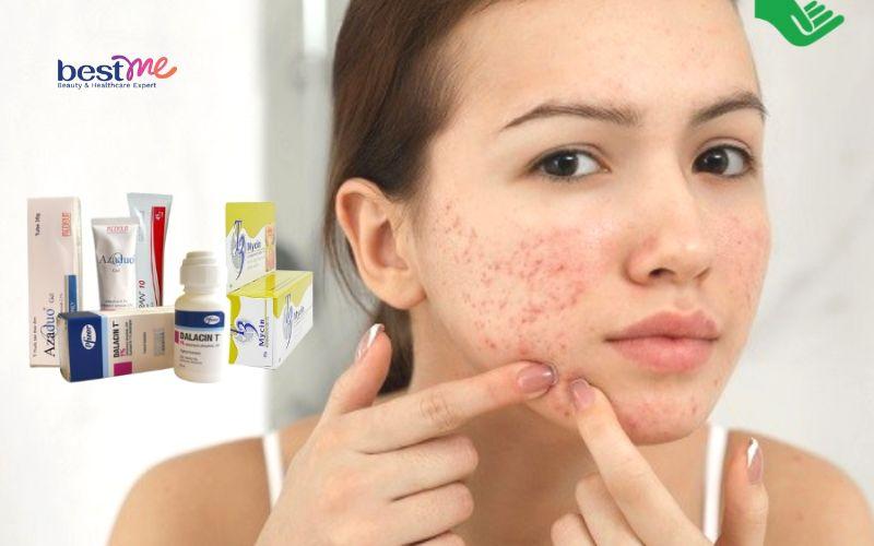 bi-quyet-dieu-tri-phat-ban-mun-trung-ca-hieu-qua-nhanh-nhat-5 Bí quyết điều trị phát ban mụn trứng cá hiệu quả nhanh nhất - 5