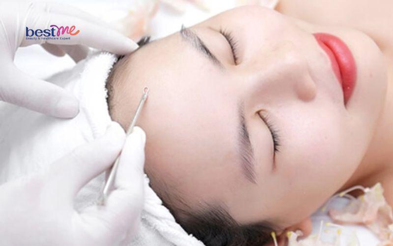 bi-quyet-dieu-tri-phat-ban-mun-trung-ca-hieu-qua-nhanh-nhat-7 Bí quyết điều trị phát ban mụn trứng cá hiệu quả nhanh nhất - 7