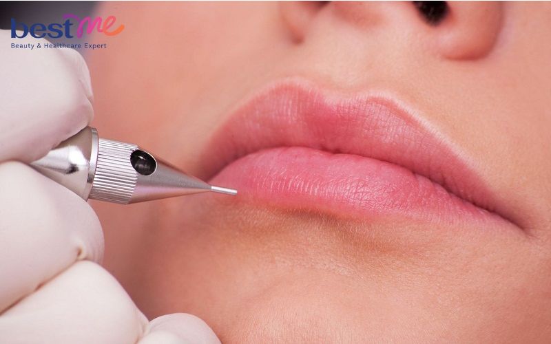 Bị tiểu đường có xăm môi được không? Các đối tượng không nên phun xăm thẩm mỹ - 1