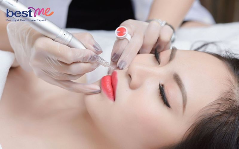 Bị tiểu đường có xăm môi được không? Các đối tượng không nên phun xăm thẩm mỹ - 4