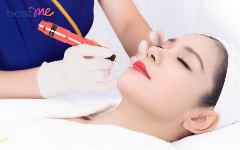 Bị tiểu đường có xăm môi được không? Các đối tượng không nên phun xăm thẩm mỹ - 6