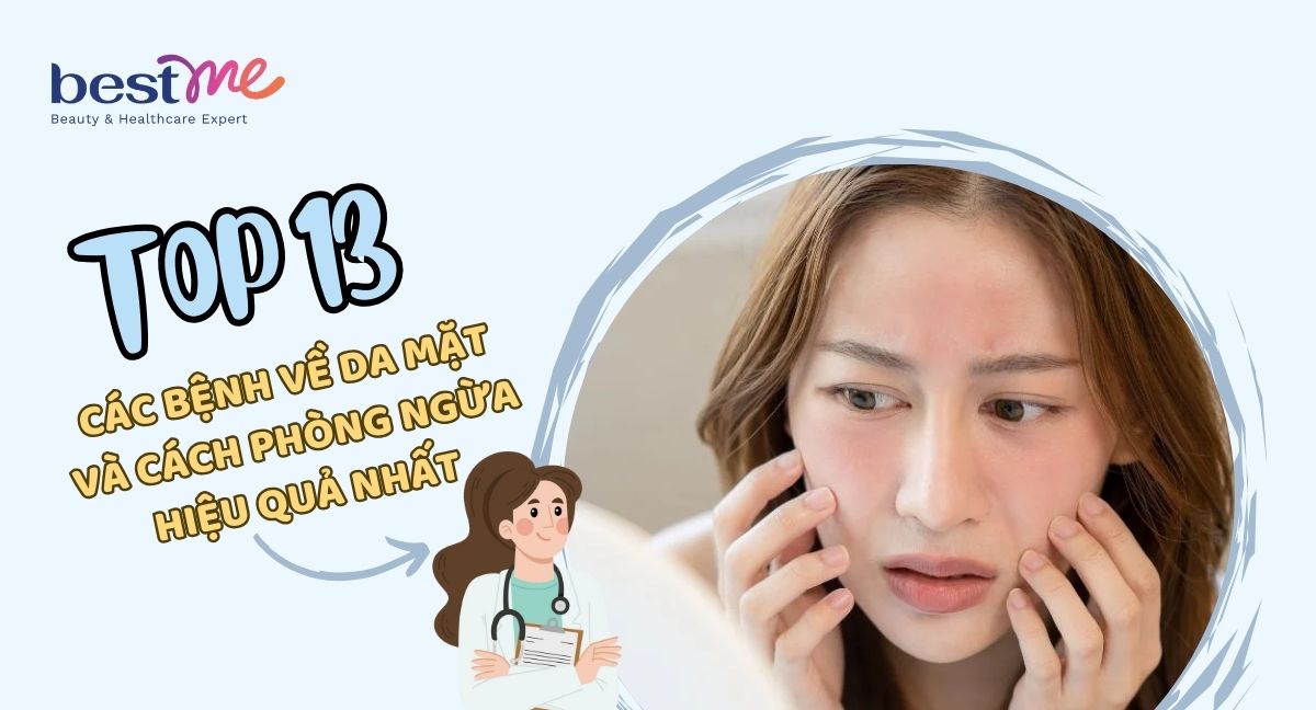 Danh sách các bệnh về da mặt và cách phòng ngừa hiệu quả