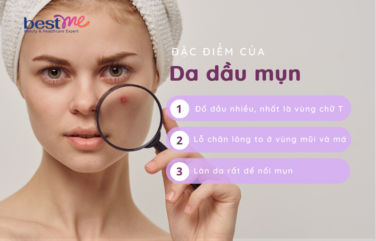 Một số đặc điểm của da dầu mụn