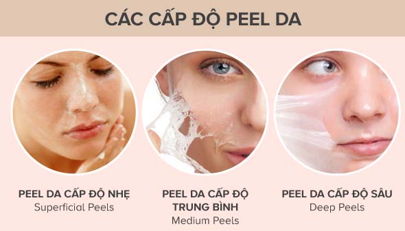 Các mức độ peel da trị mụn