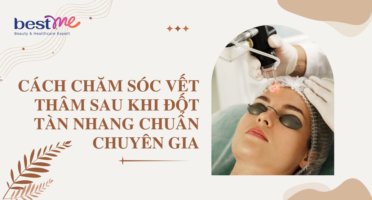 Cách chăm sóc vết thâm sau khi đốt tàn nhang chuẩn chuyên gia