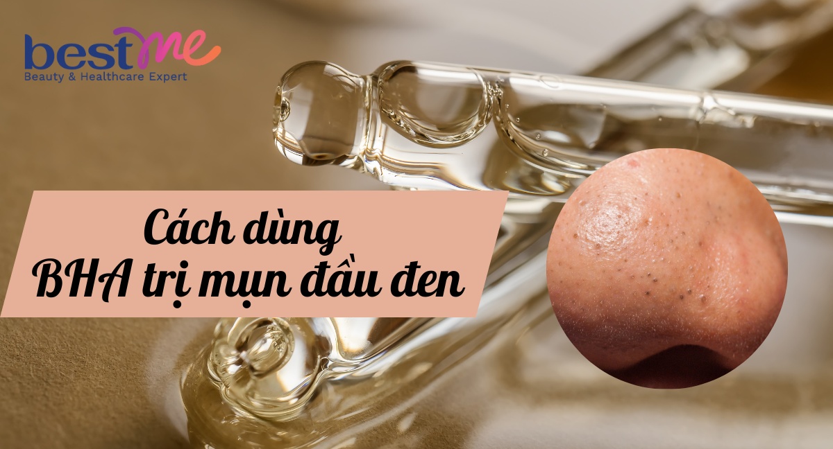 Cách dùng BHA trị mụn đầu đen và các sản phẩm hiệu quả nhất