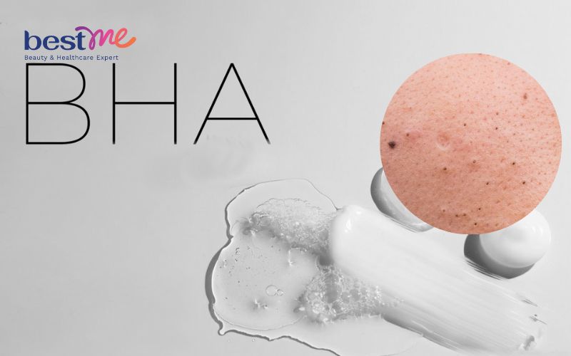 cach-dung-bha-tri-mun-dau-den-va-cac-san-pham-hieu-qua-nhat-3 Cách dùng BHA trị mụn đầu đen và các sản phẩm hiệu quả nhất - 3