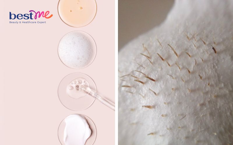 Cách dùng BHA trị sợi bã nhờn và các sản phẩm hiệu quả nhất - 1