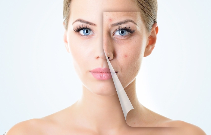 Những lưu ý để dùng retinol hiệu quả hơn