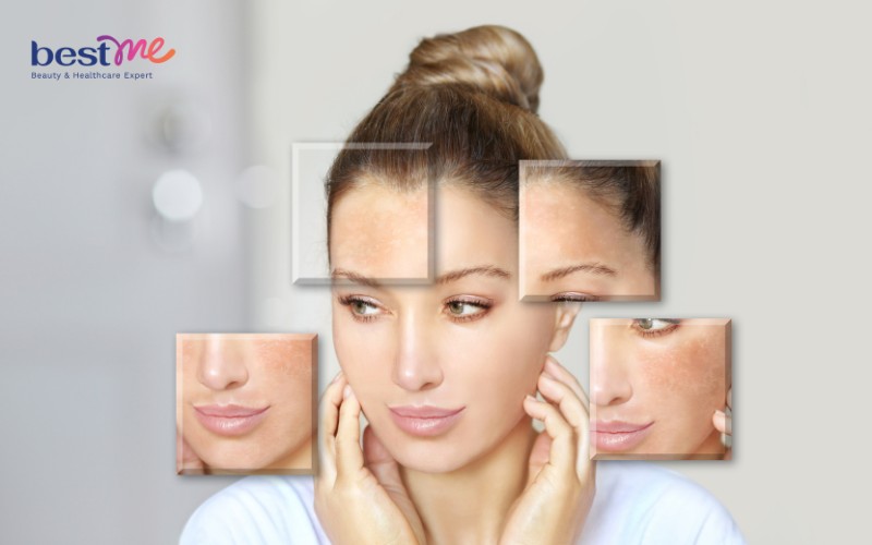cach-dung-serum-balance-vitamin-c-cho-da-sang-min-4 Cách dùng serum Balance Vitamin C cho da sáng mịn - 4