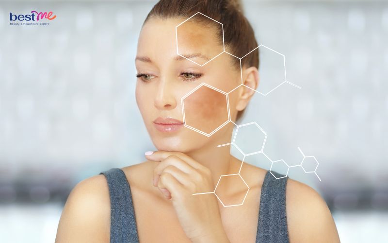 BHA cũng như là Niacinamide đều có khả năng làm sáng da và giảm thâm nám