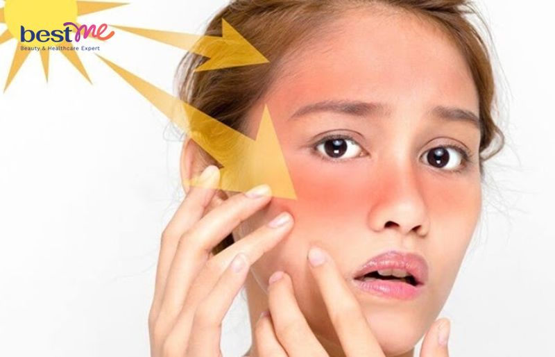 Ánh nắng mặt trời khiến da bị mỏng và yếu đi