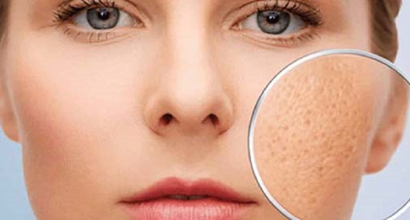 [Chia sẻ] Cách se khít lỗ chân lông ở mũi đơn giản, hiệu quả tại nhà