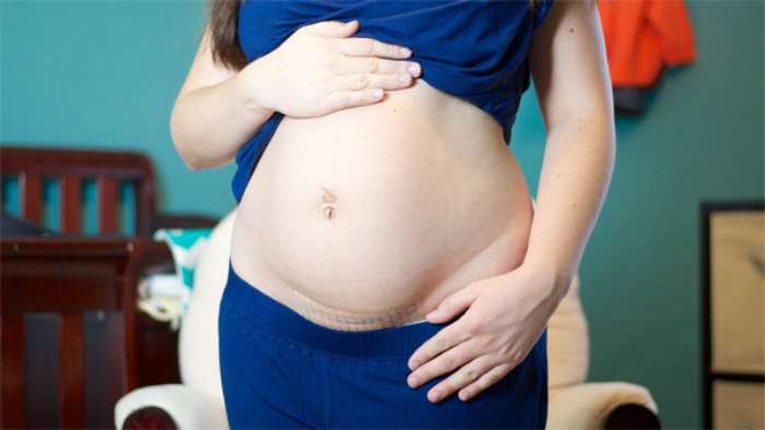 Phụ nữ sau sinh nên lựa chọn gel tan mỡ bụng riêng biệt