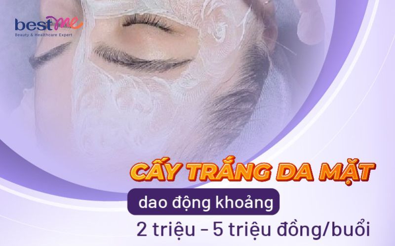Chi phí cấy trắng da mặt