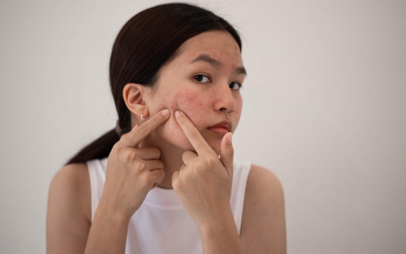 Mụn ẩn có thể chữa được và tùy vào mức độ nghiêm trọng của mụn