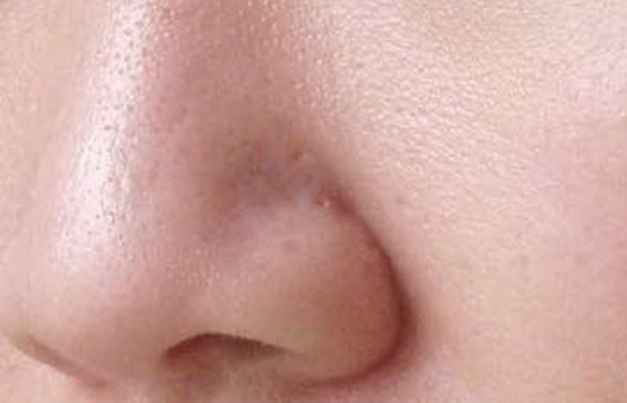 5 nguyên tắc chăm sóc da dầu lỗ chân lông to cần tuân thủ