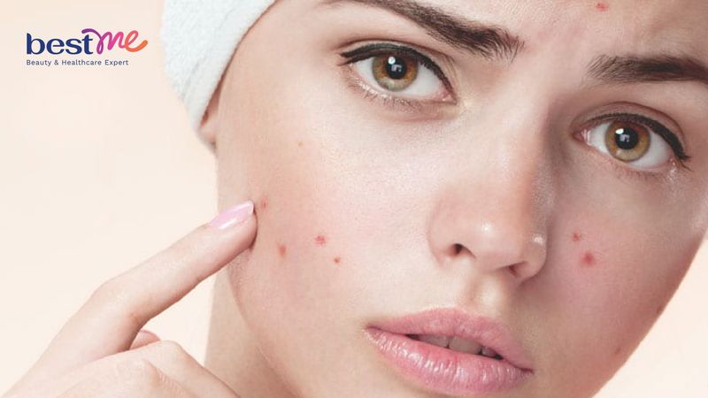 Một số đặc điểm của da khi sử dụng treatment